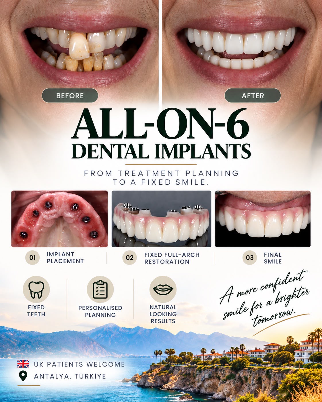 Ant Modern Diş Kliniği - 13